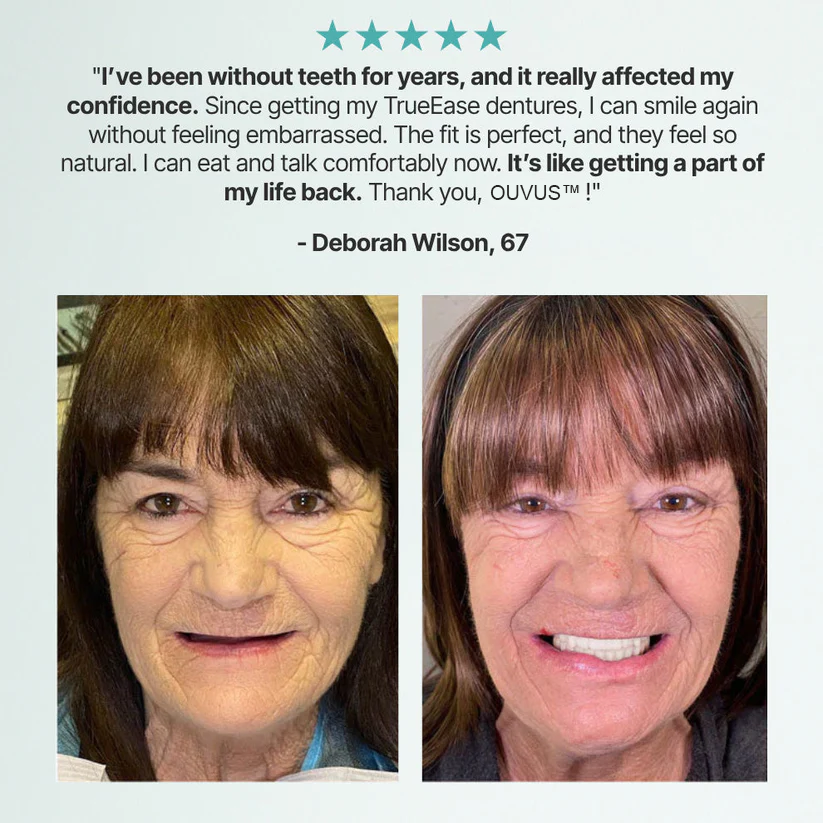 Ends Today: 70% OFF!OUVUS®? Custom-Fit Full Functional DenturesMake you more confident