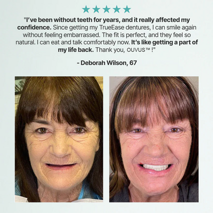 Ends Today: 70% OFF!OUVUS®? Custom-Fit Full Functional DenturesMake you more confident